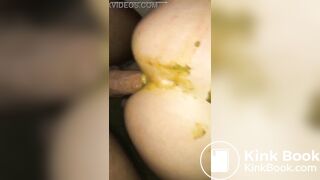 Casada deu a buceta e o cu cagado