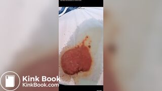 chinese cute girl poop sexy anal