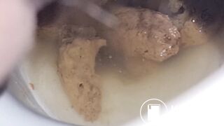 Girl Pooping & Farting Public