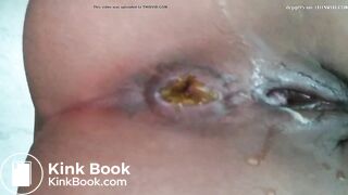 Girl pooping gets voyeured at bottom view