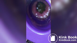 Plug time