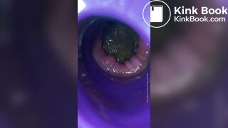 Plug time