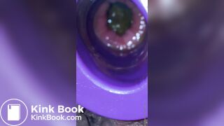 Plug time