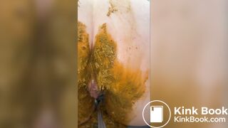 Extreme Jean Accident - video 2