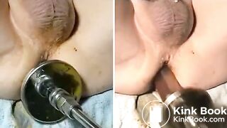 Dildo Machine Scat Fucking Again!