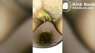 Very dirty toilet Girl Ruxandra