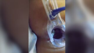 You can see her shit in her asshole?