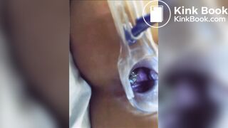 You can see her shit in her asshole?