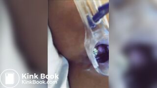 You can see her shit in her asshole?