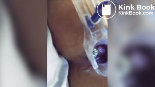 You can see her shit in her asshole?