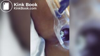 You can see her shit in her asshole?