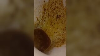 Diarrea - video 14
