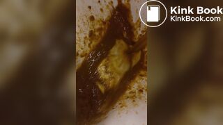 Diarrea - video 14