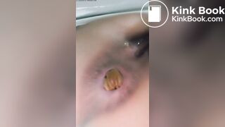Close up poop - video 22