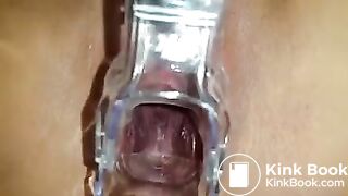 Stuffing Pussy With Shit - Scat Play