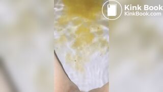 Scat Diarrhea in Pool