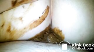 Fucking a shitting ass