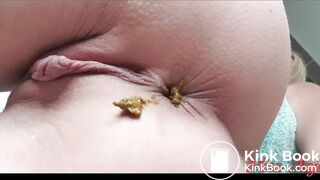 Woman has diarrhea after shower