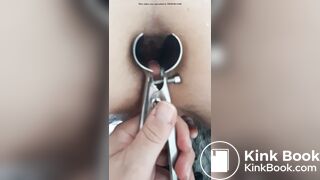 Speculum in her dirty ass