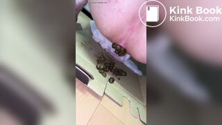 Girl’s huge poop