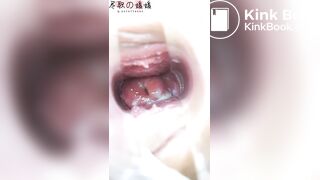 Japanese Speculum - video 5