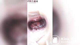 Japanese Speculum - video 5