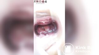 Japanese Speculum - video 5