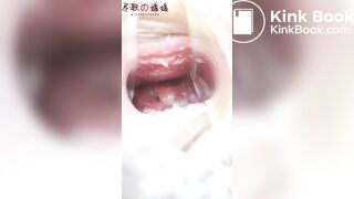 Japanese Speculum - video 5