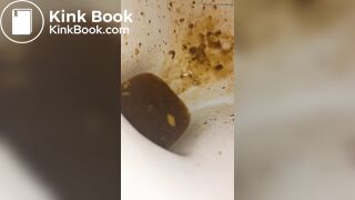 Female runny diarrhea