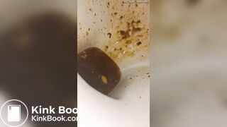 Female runny diarrhea