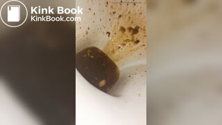 Female runny diarrhea