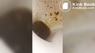 Female runny diarrhea