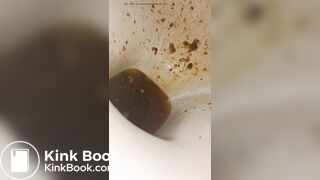 Female runny diarrhea