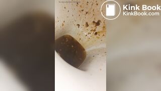 Female runny diarrhea