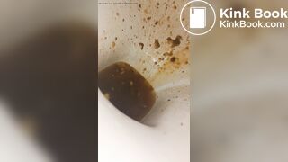 Female runny diarrhea