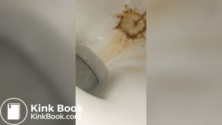 Female runny diarrhea