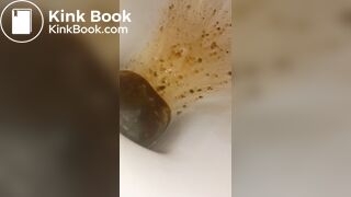 Female runny diarrhea