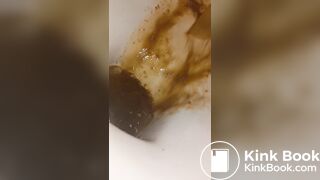 Female runny diarrhea