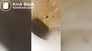 Female runny diarrhea