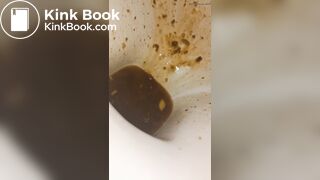 Female runny diarrhea