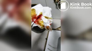 Chinese doctor diarrhea part3