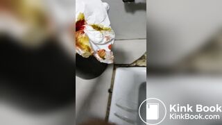 Chinese doctor diarrhea part3