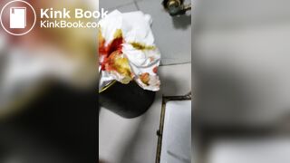 Chinese doctor diarrhea part3