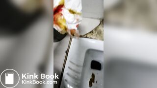 Chinese doctor diarrhea part3
