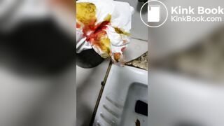 Chinese doctor diarrhea part3