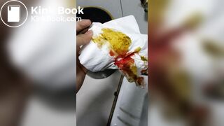 Chinese doctor diarrhea part3