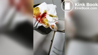 Chinese doctor diarrhea part3