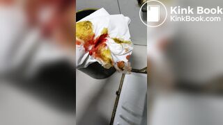 Chinese doctor diarrhea part3