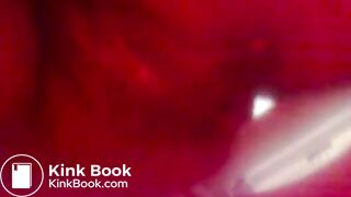 Indian aunty fart & shit