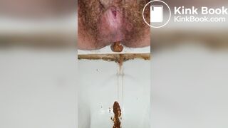 Compilation of my bowel movement